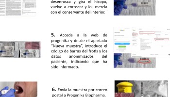 Detención de variantes alélicas del gen alfa-1 antitripsina en pacientes con fibrosis quística